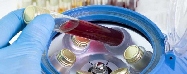 Zur Prüfung befähigte Person für Zentrifugen